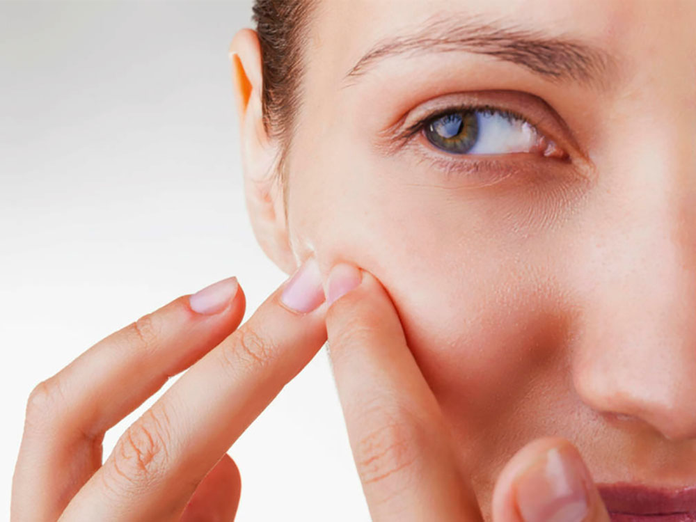 Cinco dicas para amenizar os efeitos causados pela acne 2 amenizar os efeitos causados pela acne