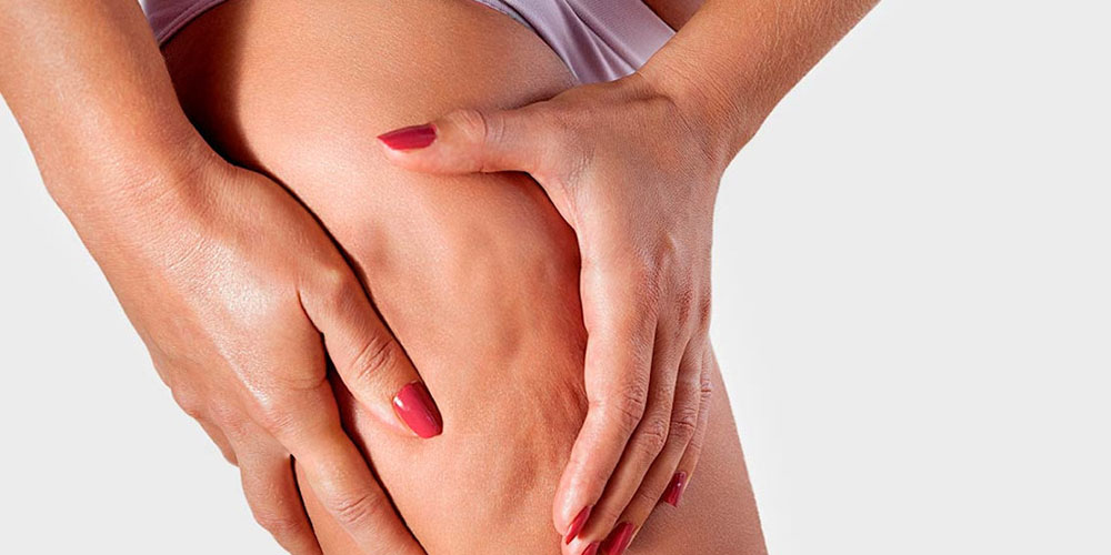 Alimentação saudável e equilibrada ajuda a evitar celulites 7 celulite Alimentação saudável e equilibrada ajuda a evitar celulites