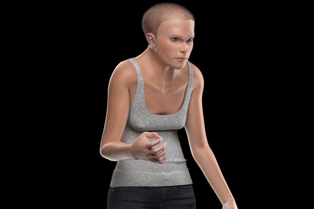 Uso de celular em excesso pode causar lesão no cotovelo 6 lesao cotovelo Uso de celular em excesso pode causar lesão no cotovelo