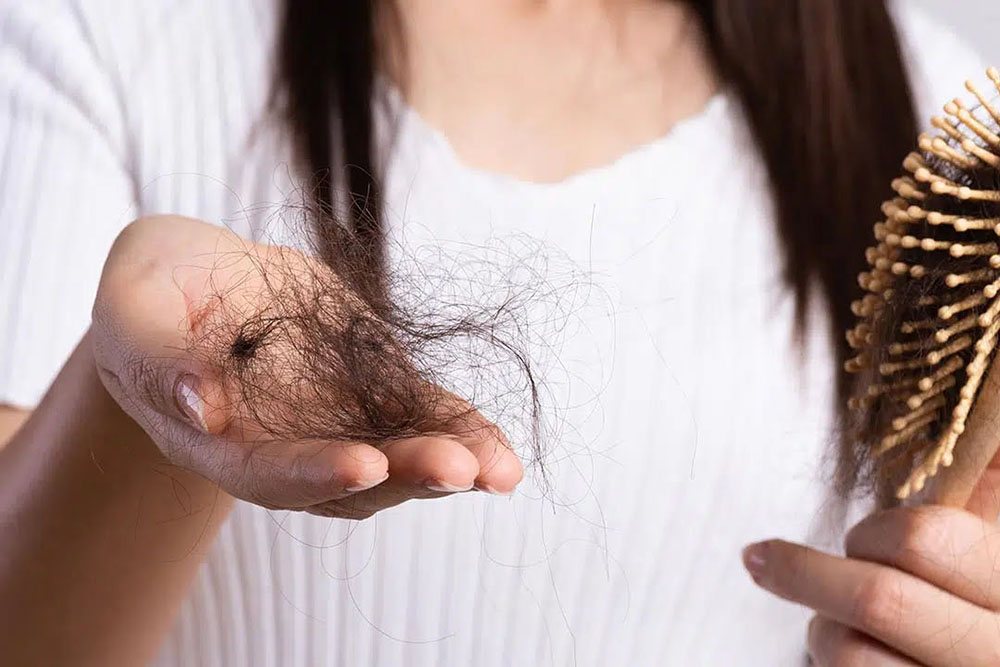 Cinco dicas para amenizar a queda capilar durante o outono e o inverno 9 queda capilar