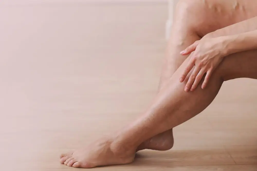 Varizes vão além da estética e podem se tornar um problema grave de saúde 1 Varizes