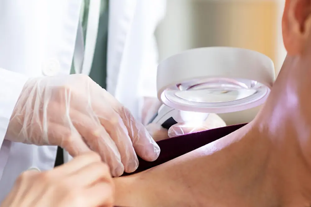 Janeiro Roxo: Mês de conscientização e combate à Hanseníase 5 Janeiro Roxo