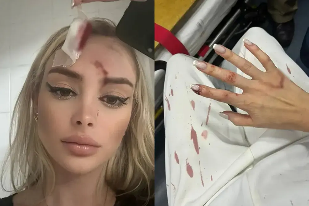 Abrabar orienta categoria para evitar casos de violência e importunação em estabelecimentos 2 violência e importunação