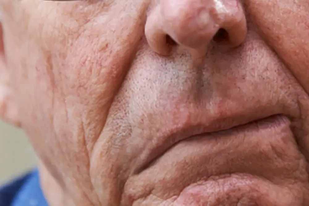 Mais de 110 mil brasileiros morreram por AVC até novembro de 2023 1 AVC