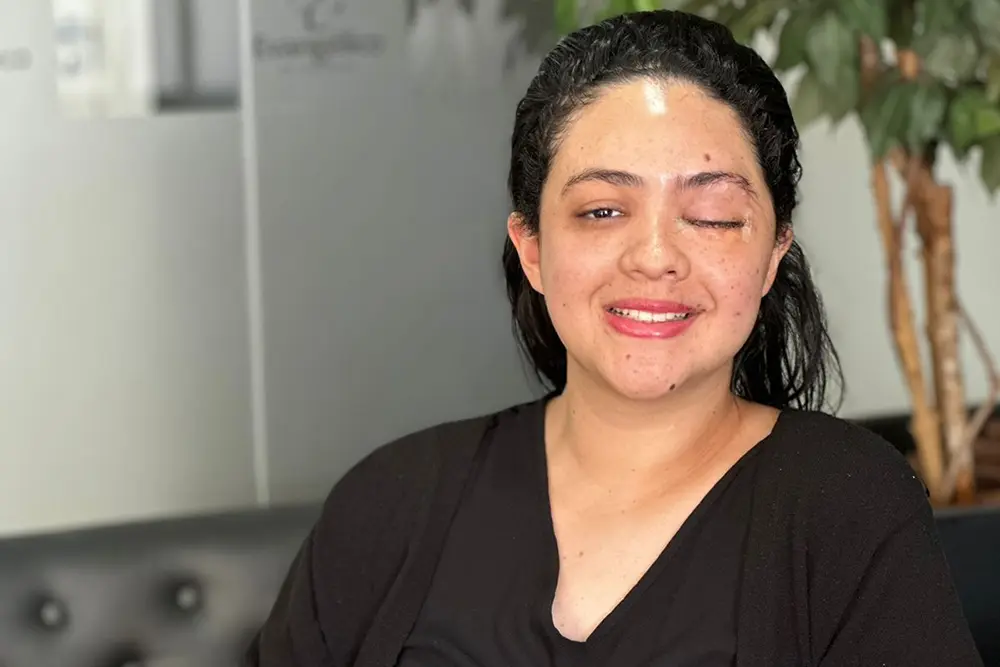 Cirurgia inédita é feita no Brasil para reconstrução facial 2 reconstrução facial