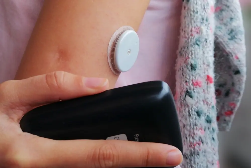 Crianças com diabetes tipo 1 recebem sensores para monitorar a glicemia 3 Crianças com diabetes tipo 1