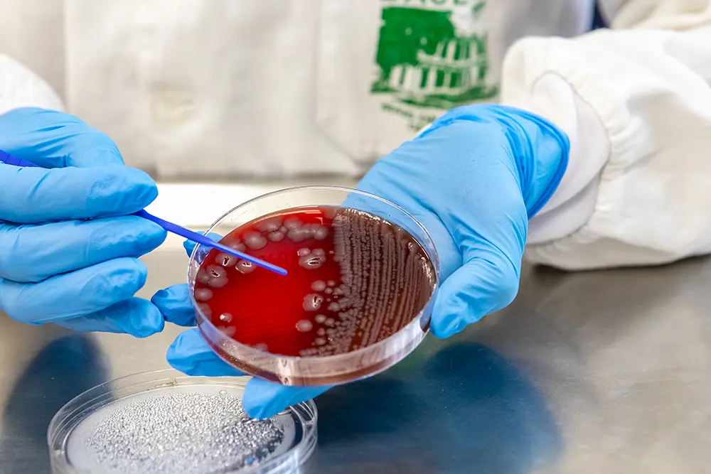 Secretaria da Saúde alerta para ações de prevenção de doenças gastrointestinais 5 doenças gastrointestinais