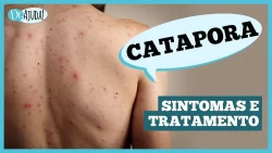 Catapora