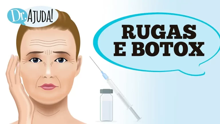 rugas e botox