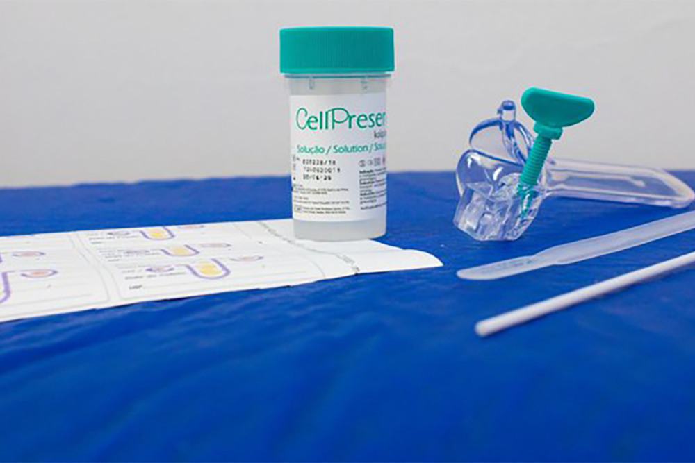Ministério da Saúde implementa teste molecular de DNA-HPV para câncer do colo do útero no SUS 4 câncer do colo do útero