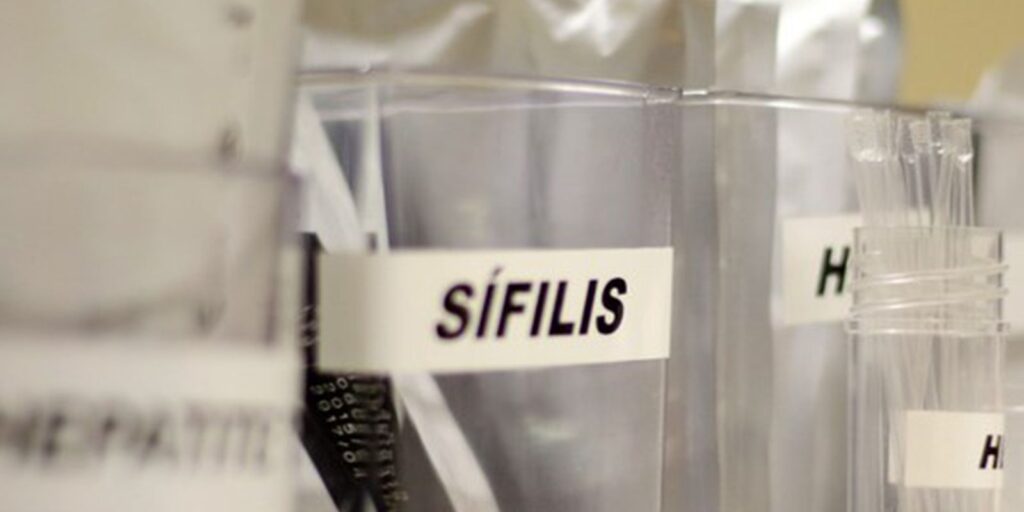 Testagem gratuita de ISTs: HIV, Sífilis e Hepatites em SP 1 01429ac5 e6cc 4402 9562 f29258f2ecda Testagem gratuita de ISTs: HIV, Sífilis e Hepatites em SP