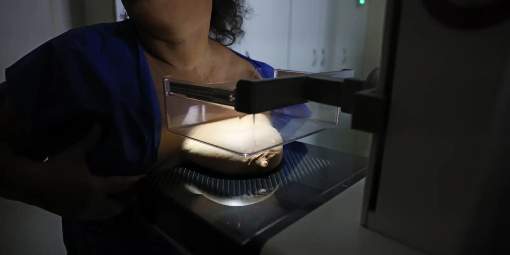 0d9a1809 ANS propõe cobertura universal de mamografia digital
